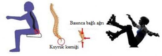 ok Oturmaktan Kuyruk Sokumu Ars